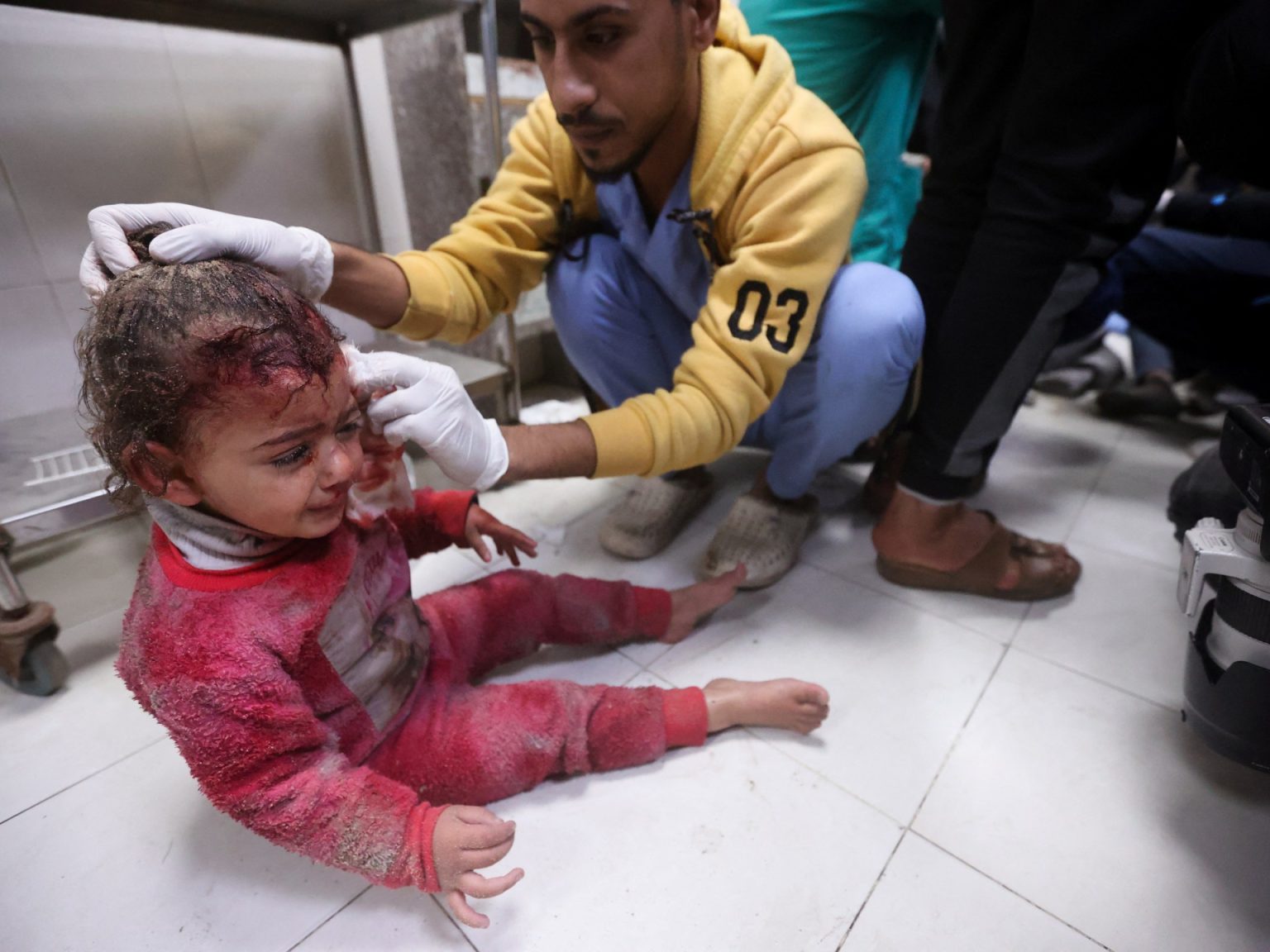 طبيب فلسطيني: كل يوم يموت المصابون أمام عيني وأنا عاجز عن إنقاذهم