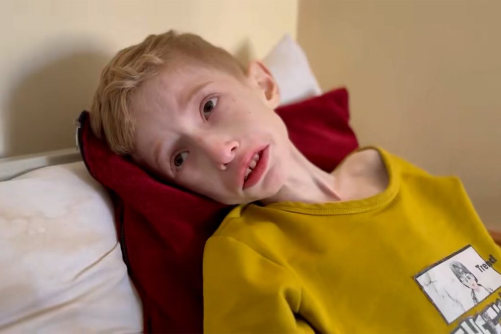 فادي الزنط.. طفل يصارع الموت جوعا ومرضا بشمال غزة وأمه تناشد العالم