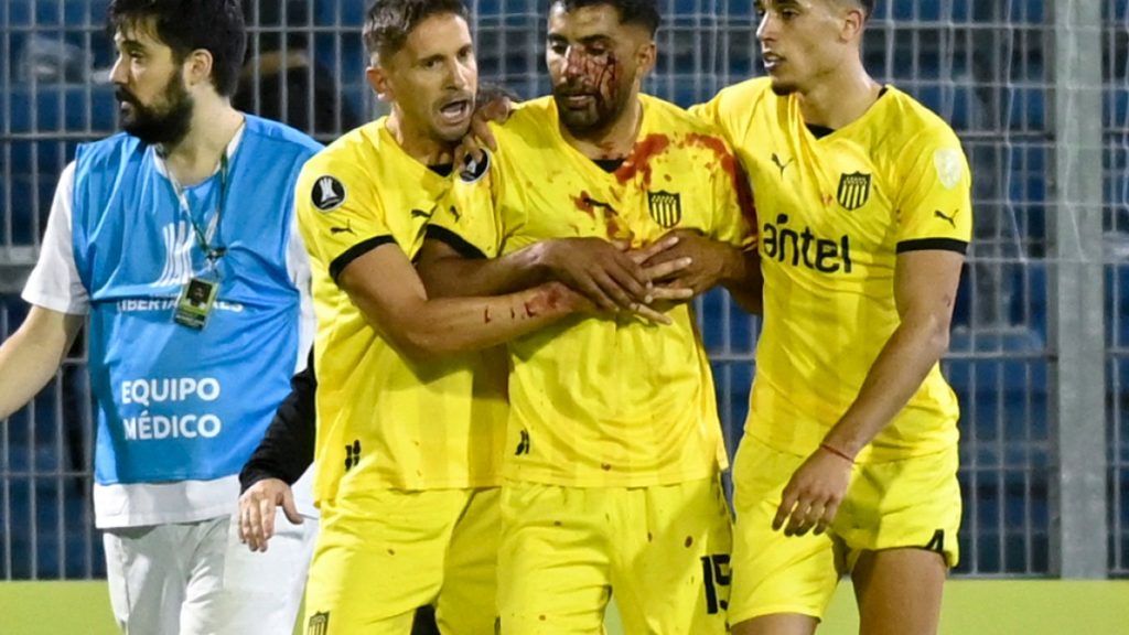 بالفيديو.. اعتداء دموي في مباراة بكأس ليبرتادوريس