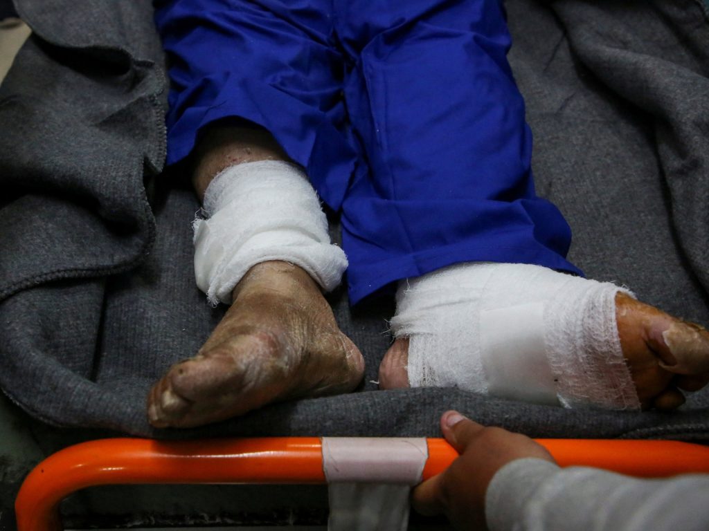 الغارديان تفضح التعذيب الذي يتعرض له غزيون بمعتقل إسرائيلي