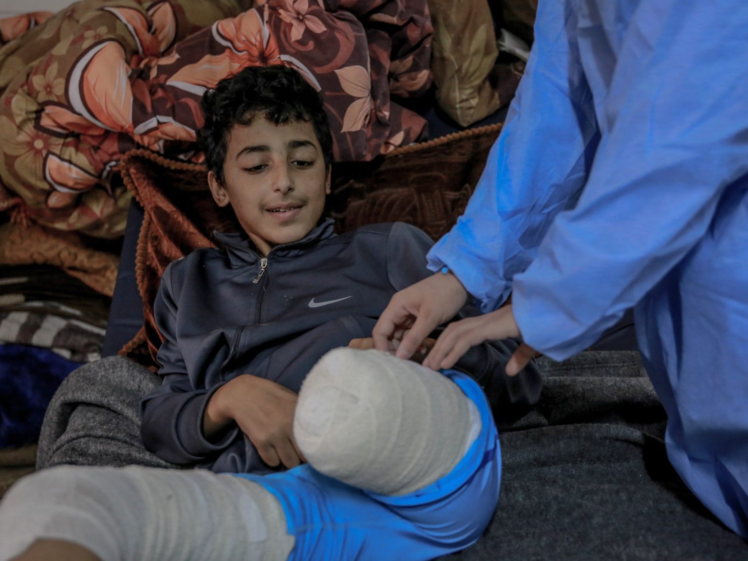 “مشهد من الجحيم”.. مبتورو الأطراف في غزة