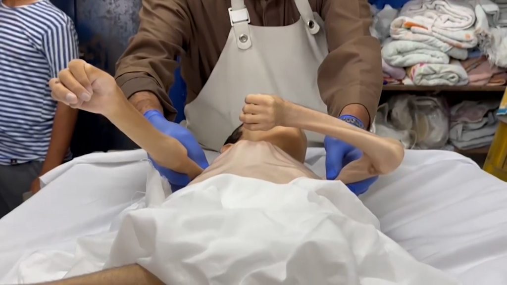 شهيد جديد بسبب المجاعة ومطالبات بإدخال ألف شاحنة مساعدات إلى غزة يوميا