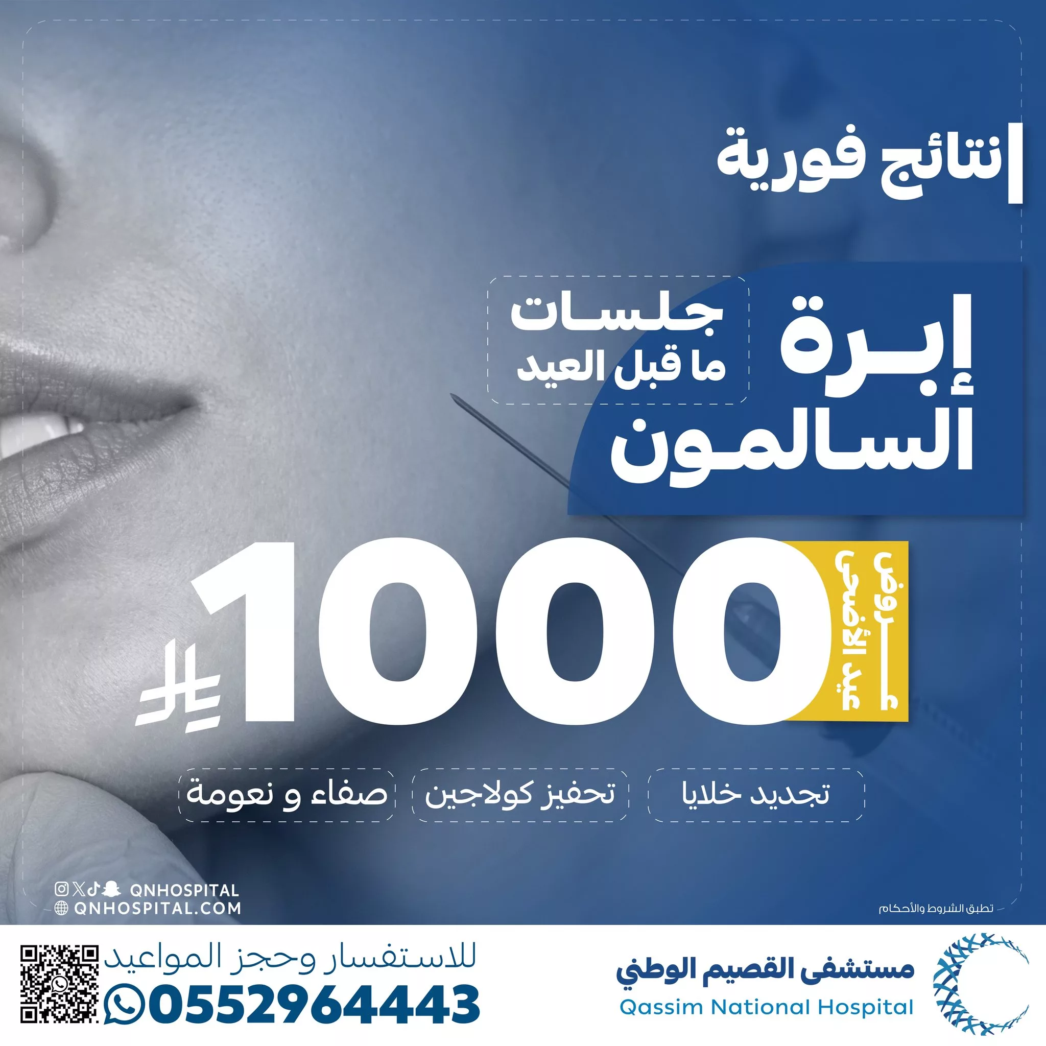 عروض تجميلية مميزة بمستشفى القصيم الوطني بمناسبة عيد الأضحى 1 4 104 - عروض تجميلية مميزة بمستشفى القصيم الوطني بمناسبة عيد الأضحى