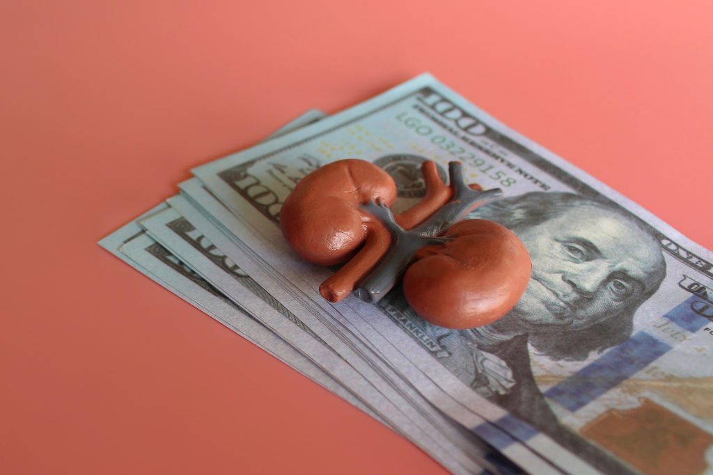 تحقيق ألماني مثير يفضح شبكة دولية لتجارة الأعضاء يقودها إسرائيلي