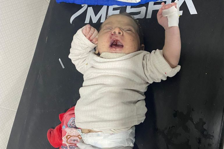 علاج الإصابات التي وصلت مستشفى العودة شمال قطاع غزة. مصدرها قسم الإعلام بمستشفى العودة.