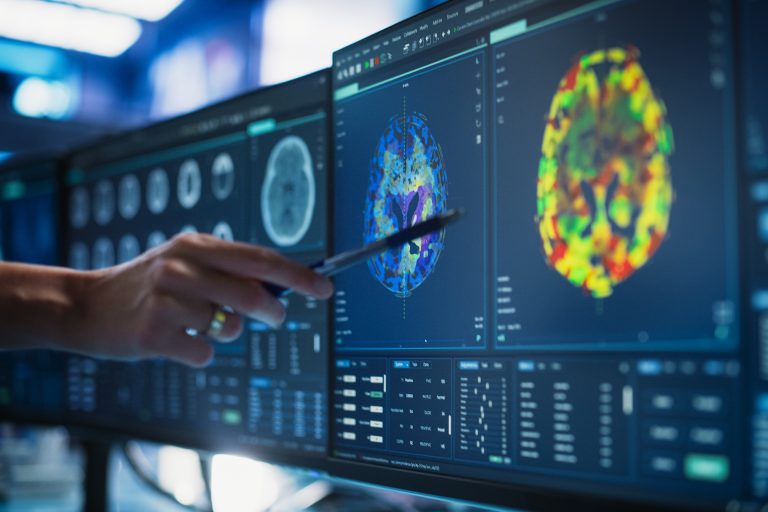 بدون عمليات خطرة.. الذكاء الاصطناعي يرسم خريطة الورم في دماغ الطفل